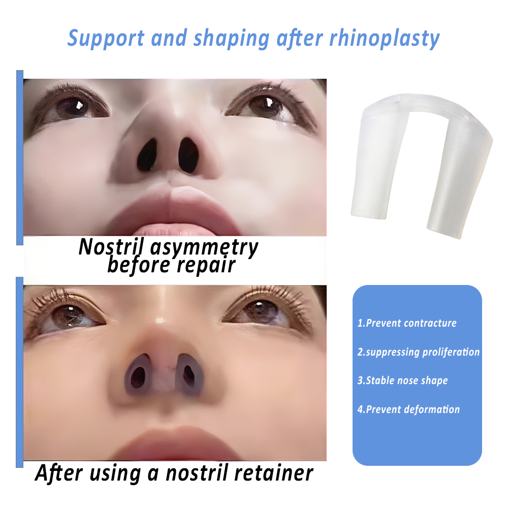 Nostril Retainer for Rhinoplas - Anti Snore Contour Pillow 评论和价格