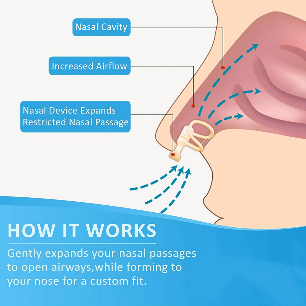 Snore Stopper Nasal Dilator fo - Anti Snore Contour Pillow 评论和价格